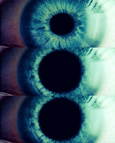 Awareness via bk